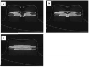 针刺X视频,揭秘传统中医与现代科技的完美融合